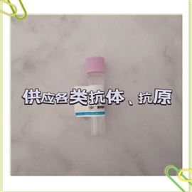 免疫球蛋白M抗原